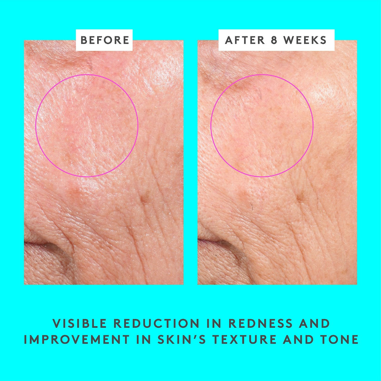 Bouncy Brightfacial Brightening Mask with 10% Azelaic Acid + 1% Salicylic Acid | Drunk Elephant