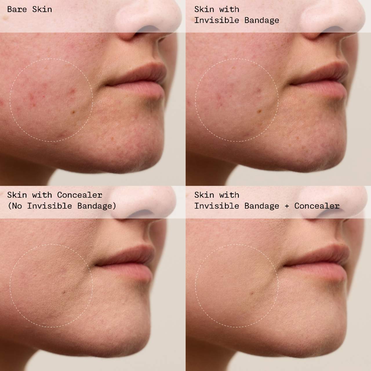 PREORDEN -INVISIBLE BANDAGE Protect + Prime Solution Gel with Niacinamide |VIOLETTE_FR - 2 A 4 SEMANAS EN LLEGAR