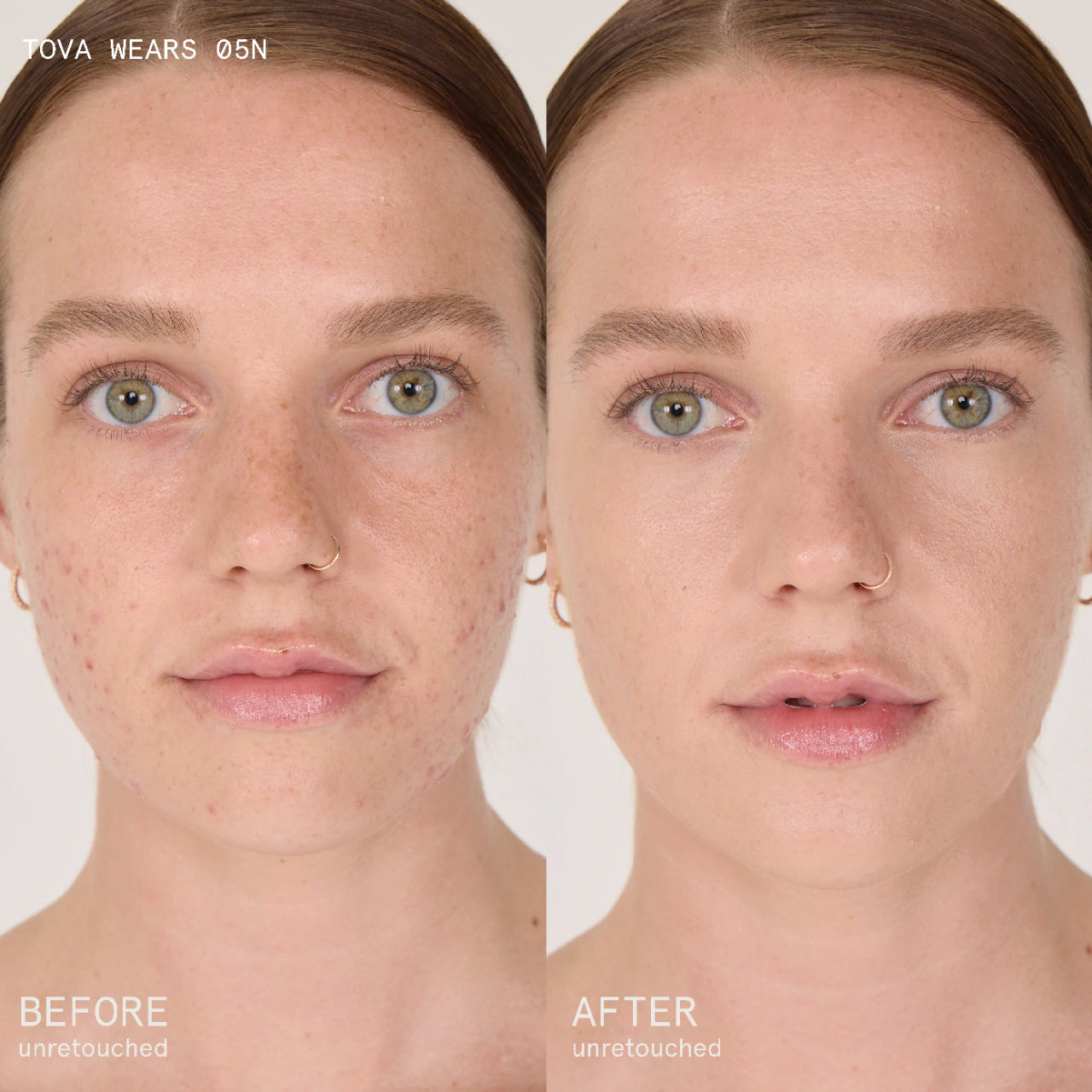 conceal & PROTECT SPF 50+ spot concealer for dark spots | CIELE