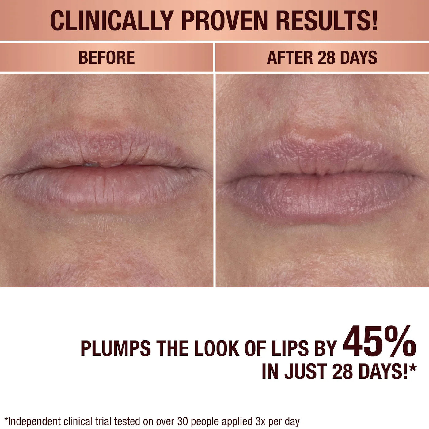 PREORDER -Life Changing Lip Mask with Cushioning Ceramides | CHARLOTTE TILBURY - 2 A 4 SEMANAS EN LLEGAR
